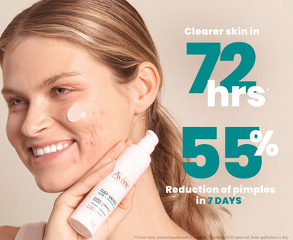 Cleanance ACNE Medicated Clearing Treatment